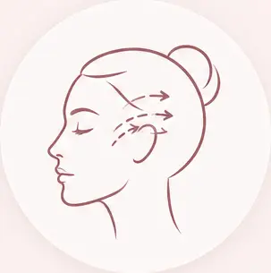 لیفت شقیقه